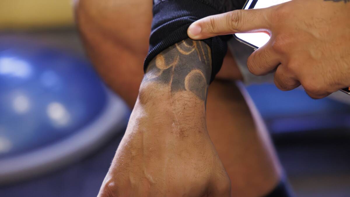 Nick Kyrgios shows the scar on the top part of his wrist from the ANAFAB surgery. Picture by Keegan Carroll.