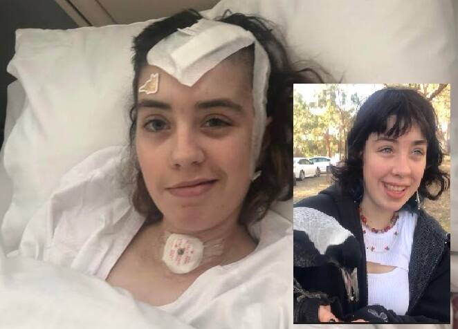 Yandoit's Kate Lewis is now able to speak, two months after cheating death. Friends, neighbours and schoolmates have rallied to help the vibrant 16-year-old, pictured with a cat sticker guarding her surgery wounds. Pictures supplied.